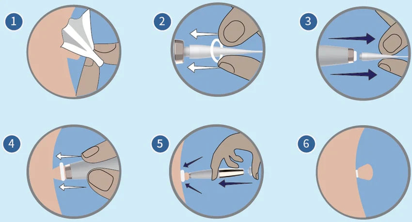Rapid Blemish Band Kit – Pain-Free Auto Tag Remover with Bands & Cleansing Swabs