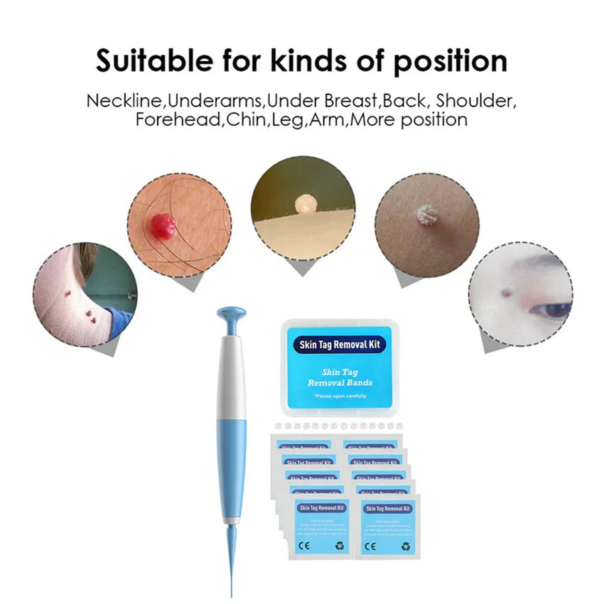 Rapid Blemish Band Kit – Pain-Free Auto Tag Remover with Bands & Cleansing Swabs
