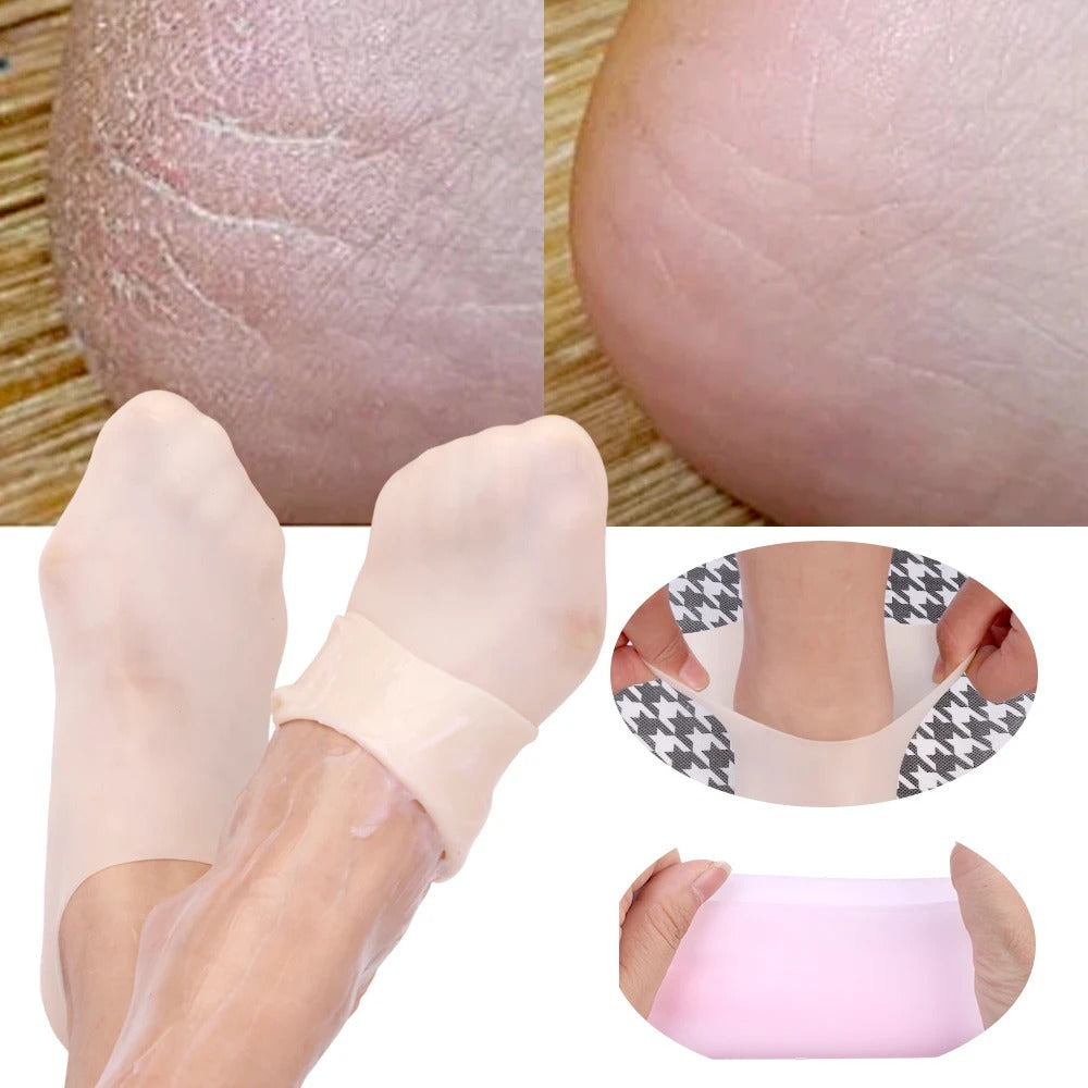 Silicone Moisturising Foot Care Socks – Gel Heel Socks for Dry & Cracked Feet (1 Pair)